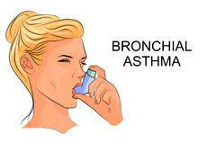 Bronchial Asthma Treatment