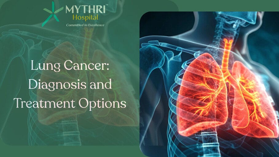 Lung Cancer Diagnosis and Treatment illustration